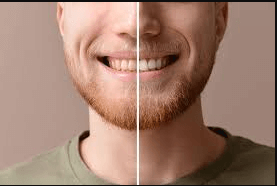 teeth cleaning before and after